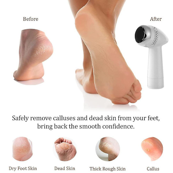 Elektrisk fil og callusfjerner, genopladelig fodsliber, pedicure fodfil callusfjerner 2000mAh (Silver)