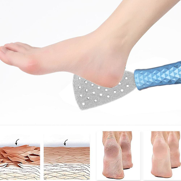 Ruostumattomasta teräksestä valmistettu muunneltava jalkaraspi- ja raspisetti, pedikyyri työkalu kovettumien poistaja jalkojen kuorinta Blue foot file (flash bag)
