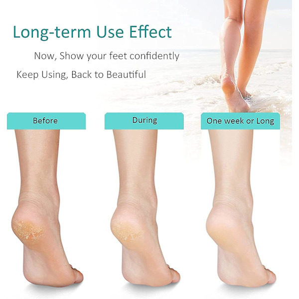 Glasfodfil Callus Remover, Fodbuffer Brusepedikyrværktøj til Mænd, Kvinder, Blød Fodpleje White * black frosted craft