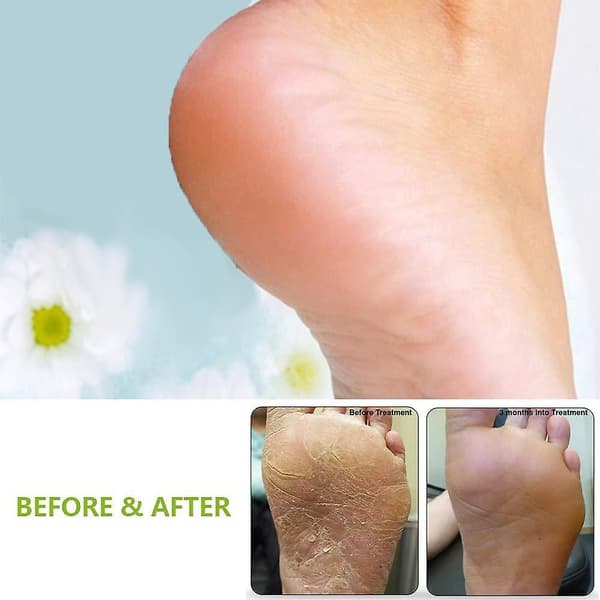 Fodfil til pedicure, callusfjerner, professionel fodrasp i rustfrit stål til fodpleje 2pcs style three black