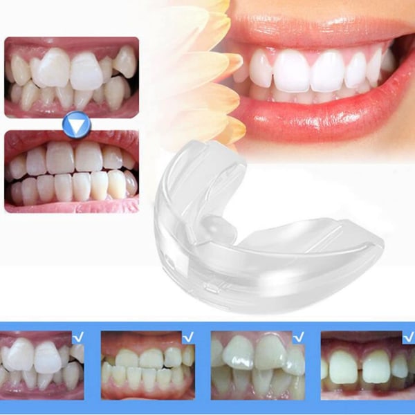 Ortodontiska tandhållare hängslen Night Guard Tandhållare för vuxna övre och nedre tandskydd - alla stadier third stage