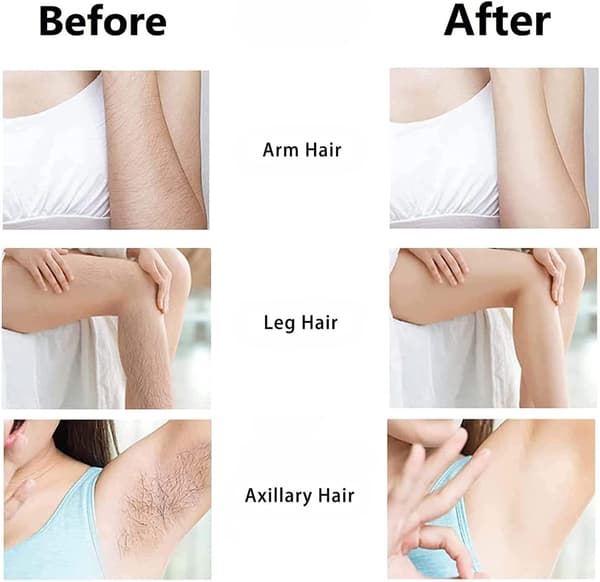 Nano Krystal Epilator Smertefri Hårfjerner Sort