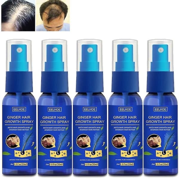 5 st återväxt närande ingefärsspray, ingefärsspray för snabb hårväxt, tät, närande hårbotten, mot håravfall, 30 ml