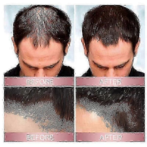 3 st Zephta H-Regrow 2.0, Zephta Håråterväxt, Prorevita Rice Nutri Spray, för hår