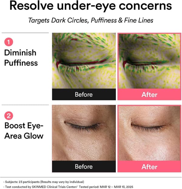 Abib PDRN Retinal Eye Patch (Glow Jelly) hjelper til med å lindre hevelser og mørke ringer under øynene.