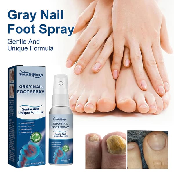 Antisopp neglebehandlingsspray i medisinsk kvalitet, 30 ml, antisopp neglebehandlinger, antisoppspray 30 ml