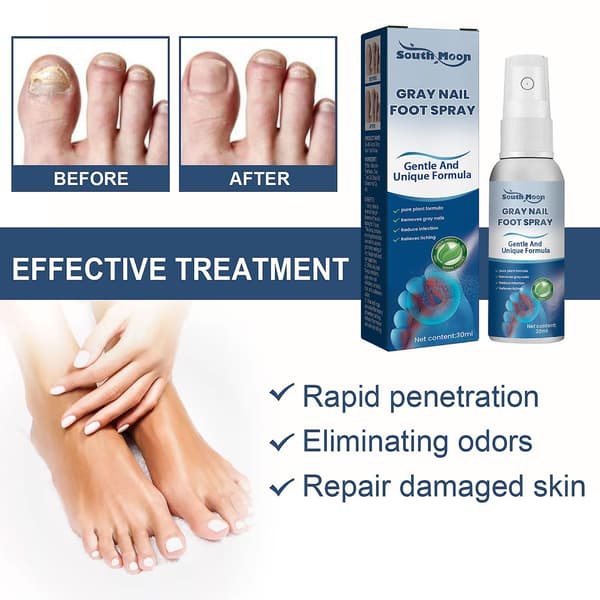 Antisopp neglebehandlingsspray i medisinsk kvalitet, 30 ml, antisopp neglebehandlinger, antisoppspray 30 ml