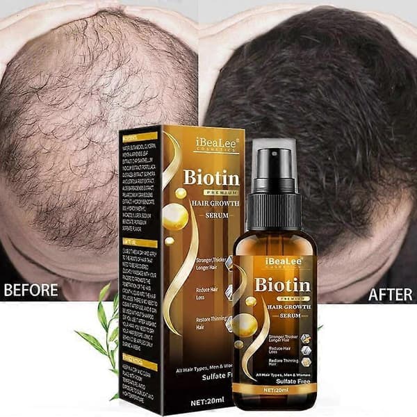 Biotin Hårbotten Närande Spray Serum, Stärkande Hårvårdsessens 20ml