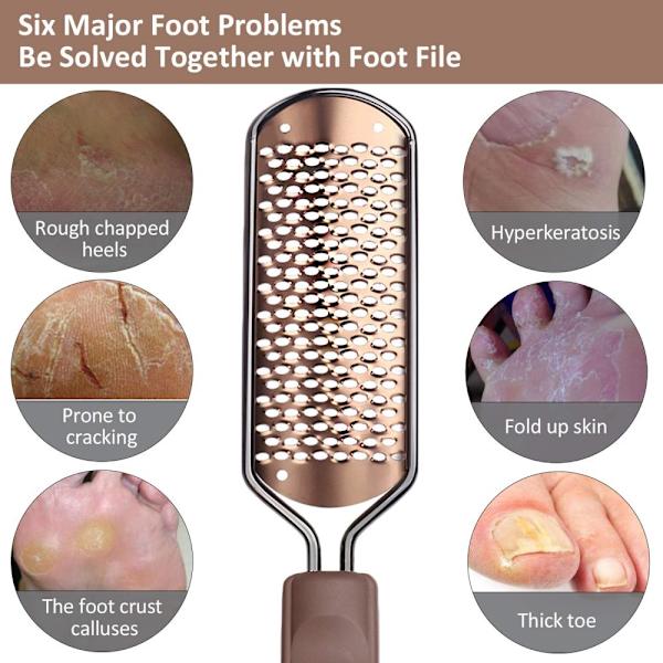 Fodfil til Pedicure - Callusfjerner - Stor Fodrasp - Kolossal Fod