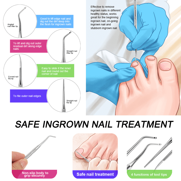 3 stk. Indgroet Negleværktøj, Neglefil og Løftere, Sikker Neglebehandling Pedikyr Værktøjssæt Under Negle Rengøring Smertelindring