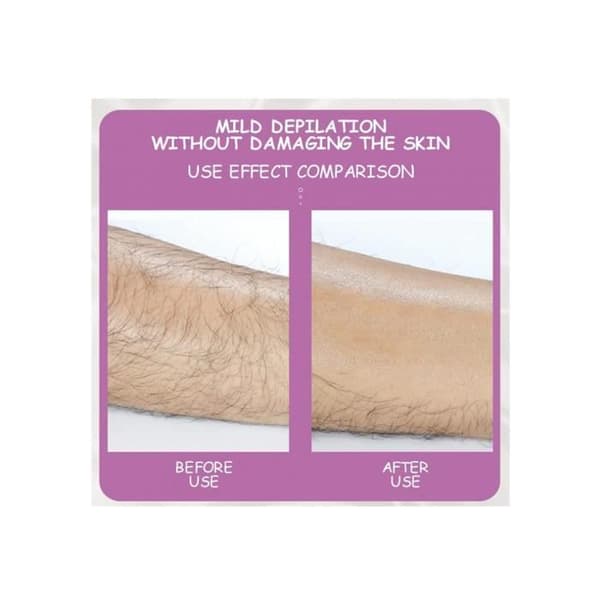 Hårfjerner - Crystal Hair Eraser - Smerteløs - Bærbar - Hårgummi - Til kvinder