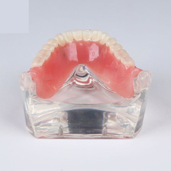 Studera Teach Model Over Denture Inferior 4 Demo Model