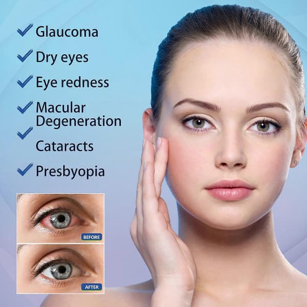 Eye Drops, Gentle Hydration, Refreshing Eye Care, Soothing Relief, 1 Set