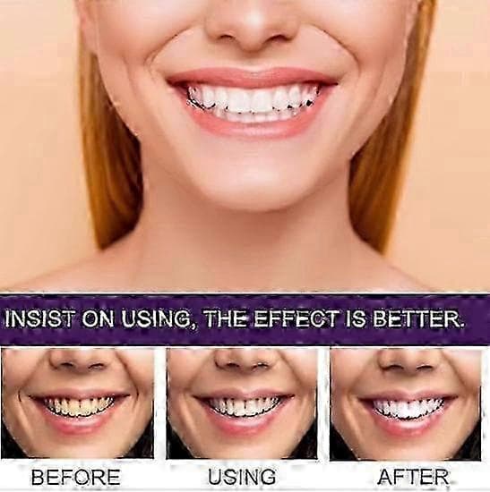 1-3X 7-Pro Intensive Toothpaste, 7PRO Intense Whitening Toothpaste with 7 2025 1PC