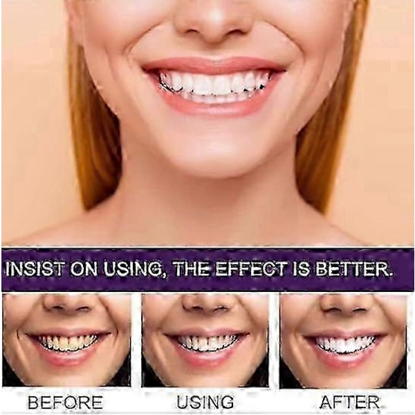 1-3X 7-Pro Intensive Toothpaste, 7PRO Intense Whitening Toothpaste with 7 2025 2PCS