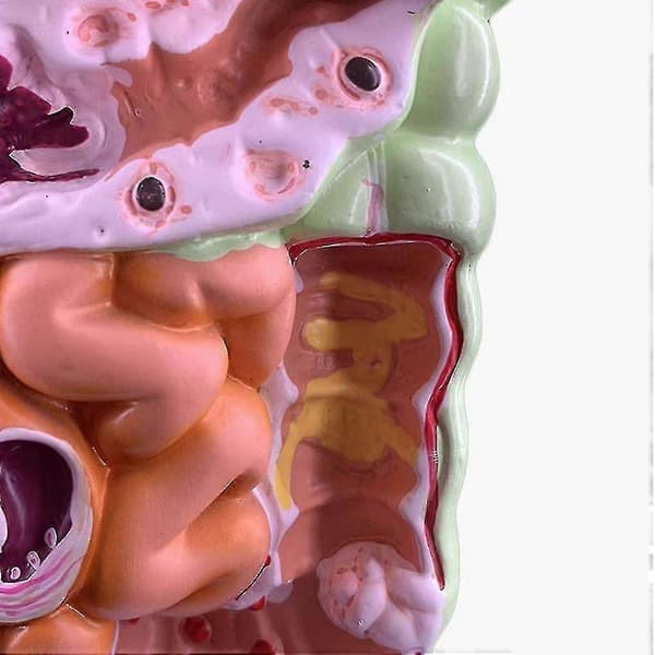 Model of the Human Digestive System, Stomach Anatomy, Large Intestine, Appendix, Rectum, Duodenum, Human Internal O-ZZY