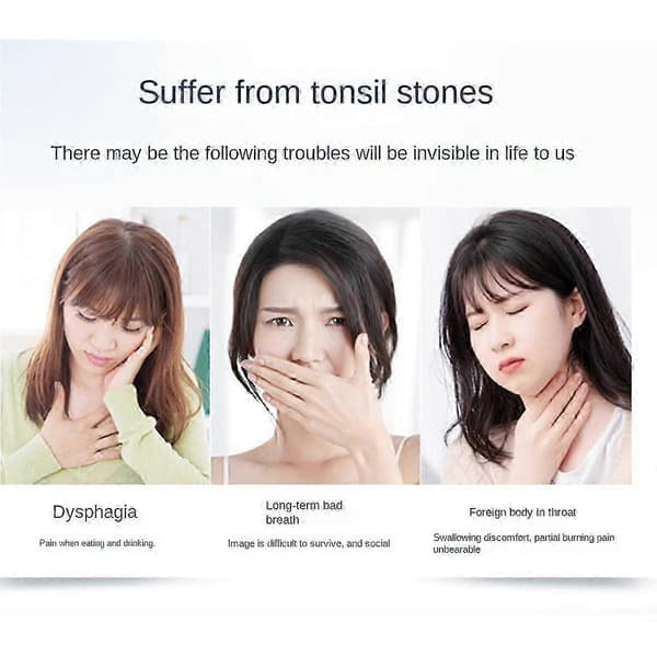 Electronic Tonsil Stone Remover, Tonsil Stone Removal Kit, Instant Suction Tonsil Stone Removal