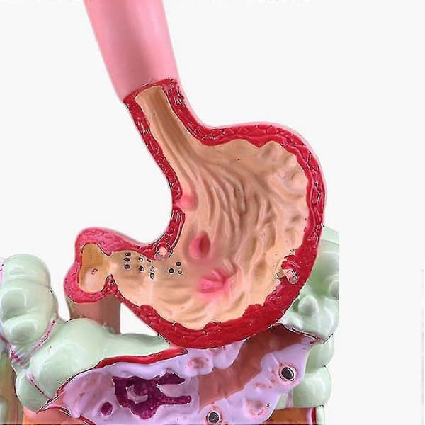 Model of the Human Digestive System, Stomach Anatomy, Large Intestine, Appendix, Rectum, Duodenum, Human Internal O-ZZY