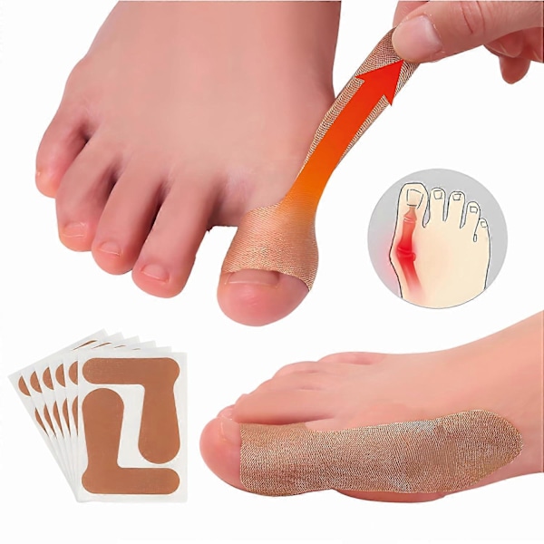 Hallux Valgus Korrigerare för Kvinnor Män Stortå, Självhäftande Stortåskydd Tumskydd Klistermärken, Elastisk Smärtlindrande Patch för Hallux Valgus 10 sheets