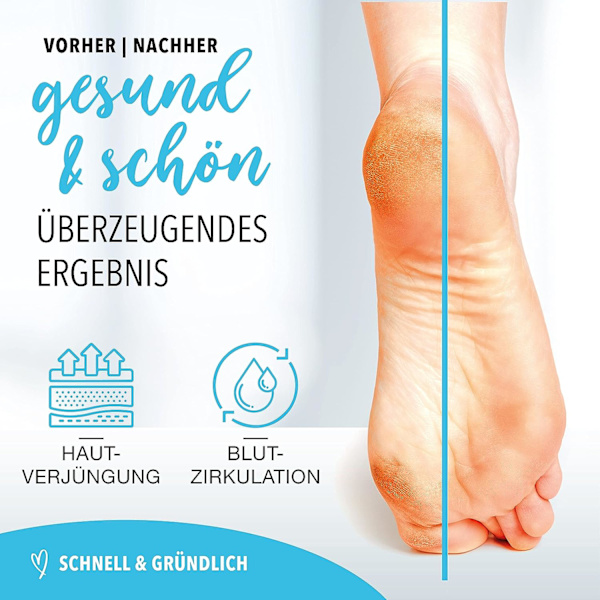 2 i 1 nano glas callus remover våt och torr, nano glas callus remover, våt och torr callus remover - nano glas callus remover
