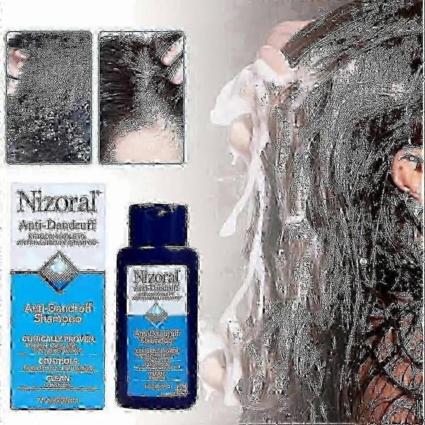 nizoral 7 fl oz 200ml hilse shampoo 2026