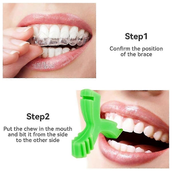 4 KPL Chewies Invisalign-oikomiskojeille, Y-muotoiset Chewies-purulelut oikomiskojeiden istuvuuden parantamiseen