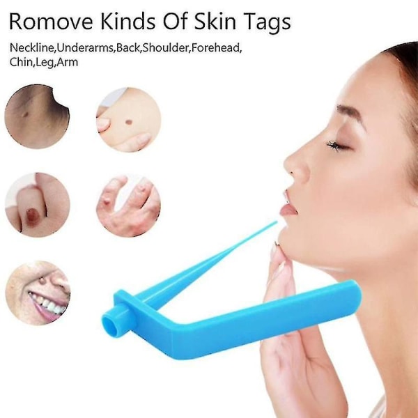 Micro Tag Band Skin Tag Remover Kit för snabb och effektiv borttagning av hudtaggar