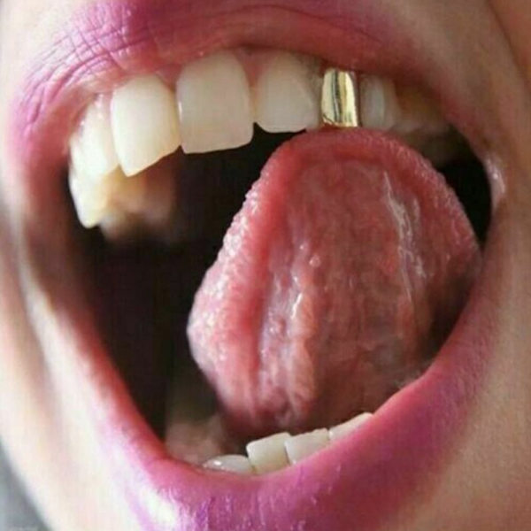 Mordely Single Tooth Caps Form GULD gold