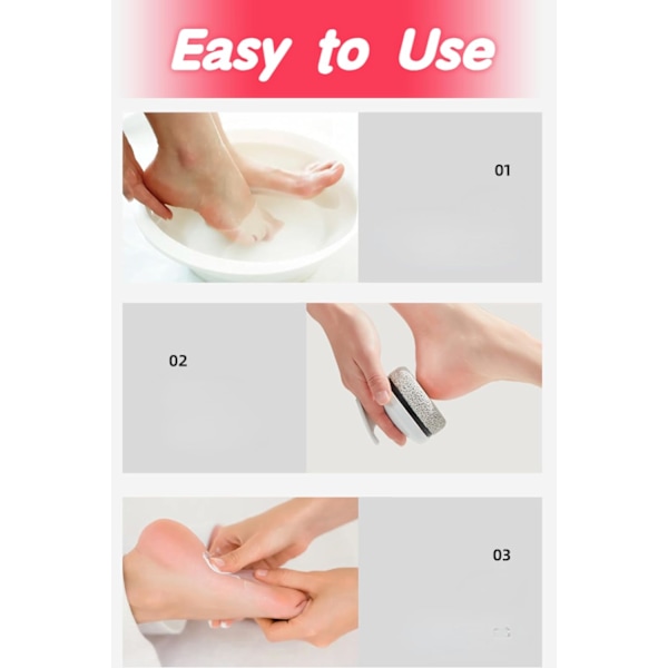 Pumice Stone Foot File med Rundt Håndtak - Effektiv Callus Remover for Glatte Føtter - Profesjonell Fot Scrubber for Dyp Rengjøring (2 Pakk, Hvit)