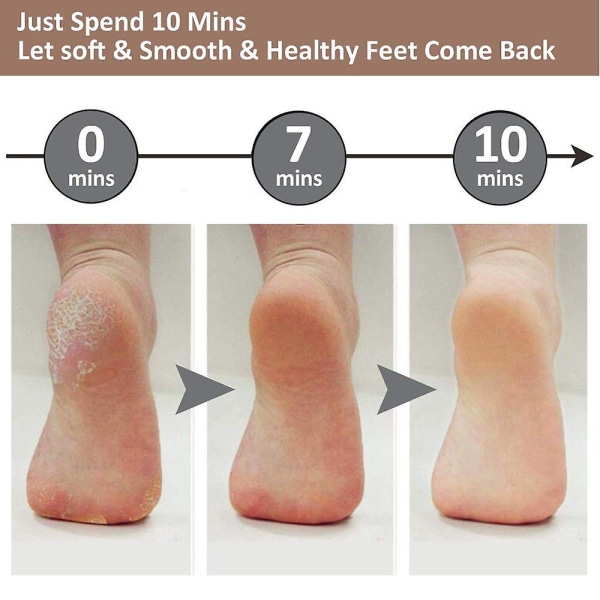 Sunrain Pedicure Foot File Callus Remover -iso Foot Rasp Colossal Foot Scrubber Professional Sta