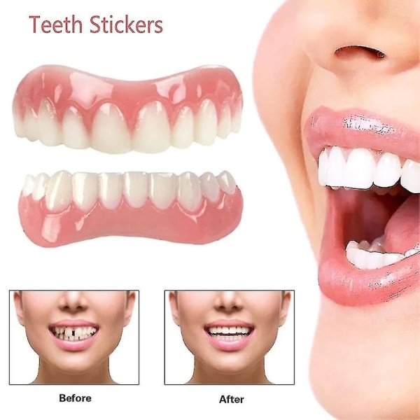 Bekväma tandfasader - Mjukt silikonlim - Extra tunn vit nyans - Ortodontisk tandsköld för proteser och tandställning