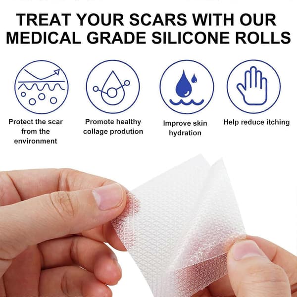 4 cm silikone arfjernelsestape efter operation ar behandlingsark smertefri arreparationsbandage, længde Transparent Transparent