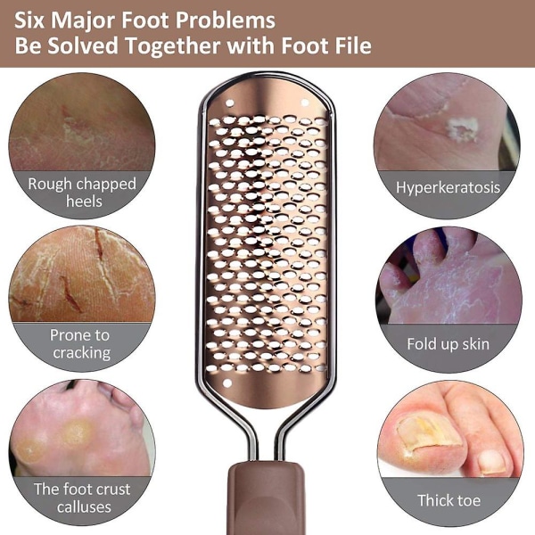 Sunrain Pedicure Fodfil Callus Remover - stor fodrasp Colossal Foot Scrubber Professional Sta