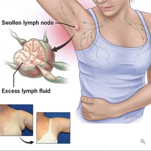4-pak lymfedrænage terapi magnetiske ringe, justerbare lymfedrænage ring terapi magnetiske ringe, unisex