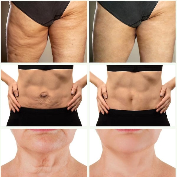 Retinol Anti-aging Body Cream Anti Wrinkle Skin Care Firming Cellulite Sagging -GSL