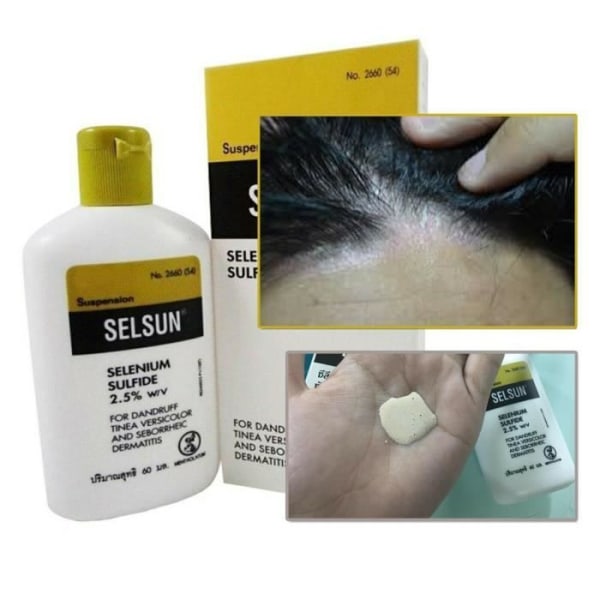 120ml Selsun Sulfide 2,5% Mjällschampo Svampdermatit | Anti-mjäll | Mot håravfall