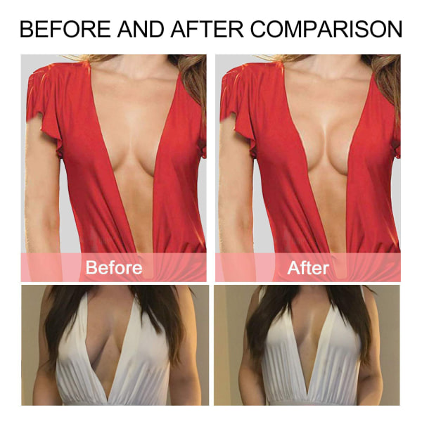 EElhoe 2st BH brösttejp Bröstlyftande tejp klistermärke för kroppsbröstklister