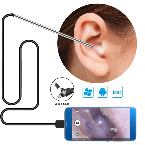 Betterlifefg-3 in 1 Öronvaxborttagningsverktyg USB Otoskop-Ear Scope Kamera In Ear Cleaning Endoskop Visual Ear Spoon 5,5 mm Earpick Otoscope