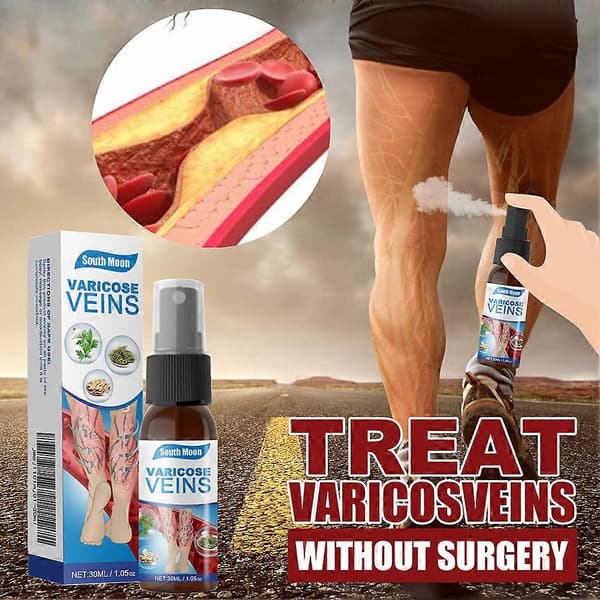 Spray mot åderbråck för ben Åderbråck, Vein Guard Herbal Spray Åderbråcksbehandling Spray 2pcs