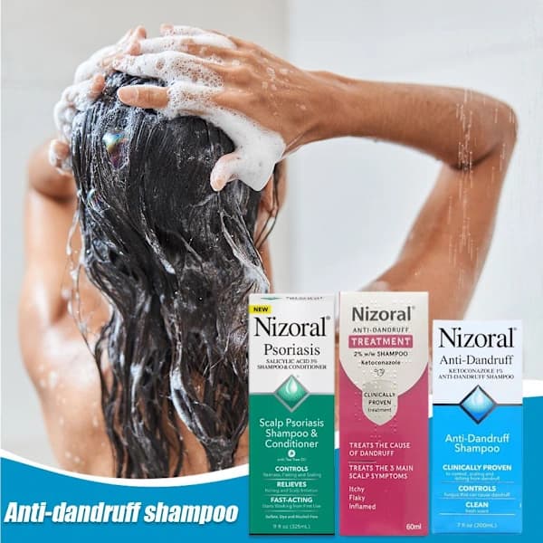 Ketoconazol Anti-Skæl Shampoo — Lindrer Kløe & Forebygger Hårtab — 200ml (1 Flaske)