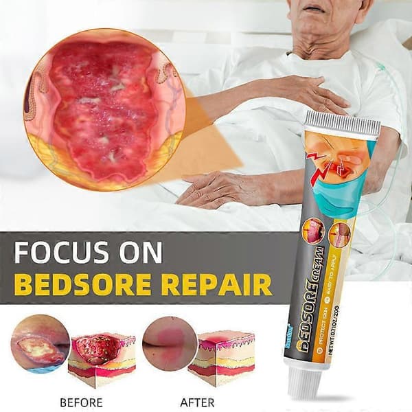 1-5X Sengecreme Sengesår Salve Sengesår Hurtig Sår Decubitus Ulcus Behandling Til Hurtig Sårreparation 20g 3PCS