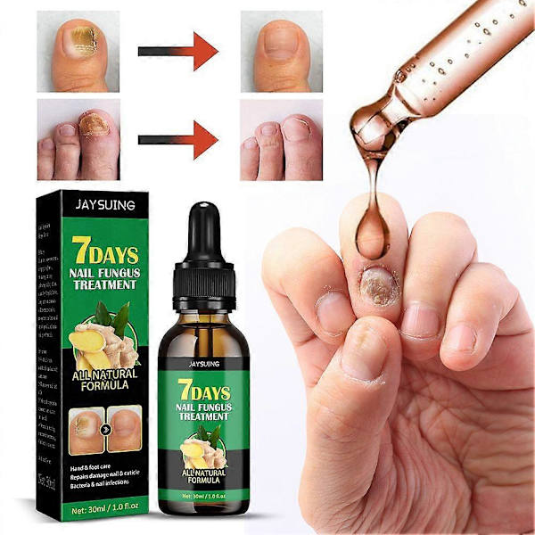 7Days Inkiväärikynsihoito, monikäyttöinen kynsien korjaus, kynsien ravintoöljyä vahvistava öljyseerumi inkiväärikynsien kasvuöljy