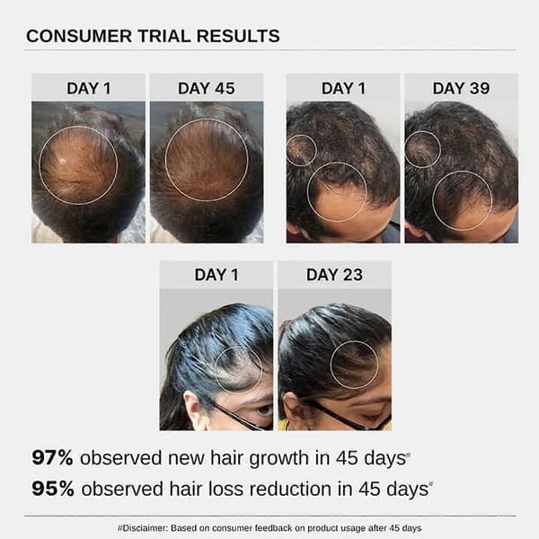 Bare Anatomy Advanced Hair Growth Serum - 30ml