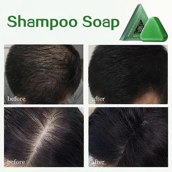 Nature Seven Green Soaps Sjampo Usman Gress Hårvekst Sjampobar Tykkere Styrker Hår for Kvinner Menn 3pcs