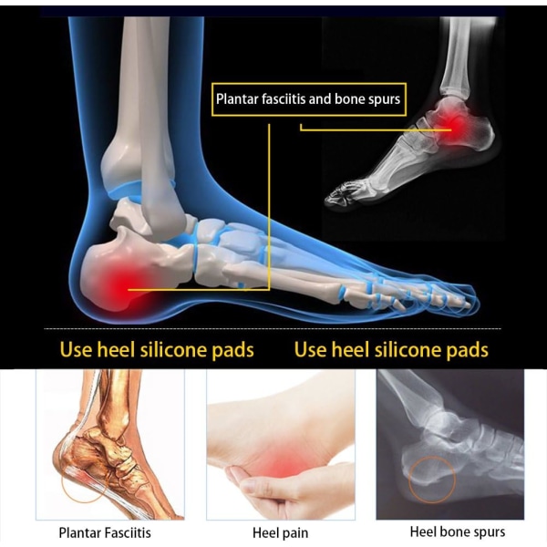 3 par gelhælkopper for plantar fasciitt - silikon gelhæl