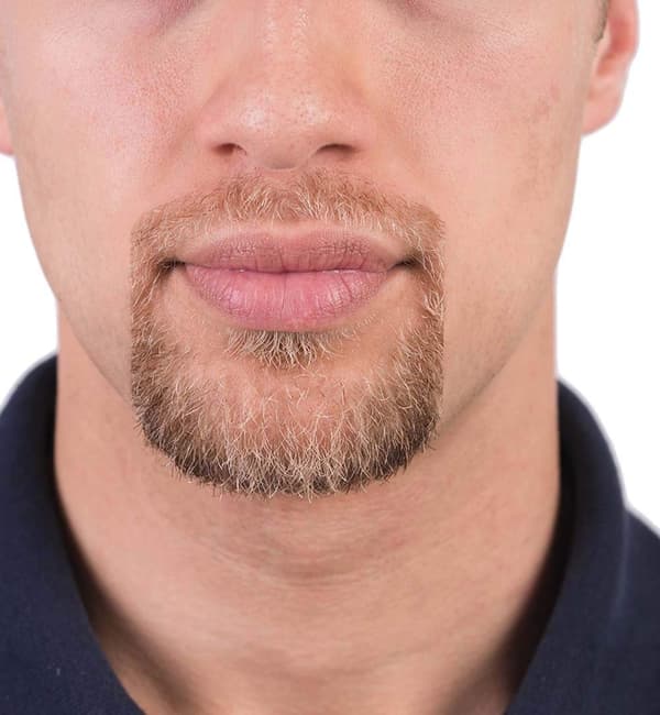 5 størrelser Goatee Skæremal Beard Guide Shaper Beard Shaping & Styling Skabelon til Mænd