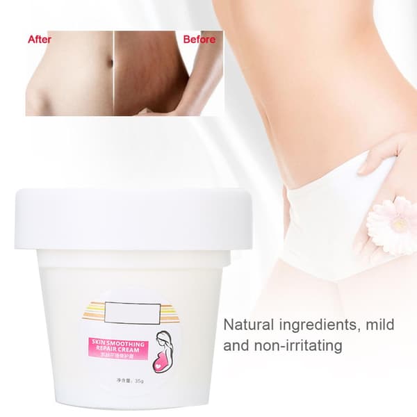 Fjernelse af strækmærker creme - Beroligende behandling for graviditetsar, 35g