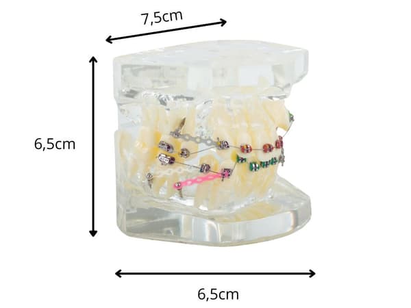 Tandmodell med tandställning, ortodontiskt undervisningsverktyg, 6,5 cm