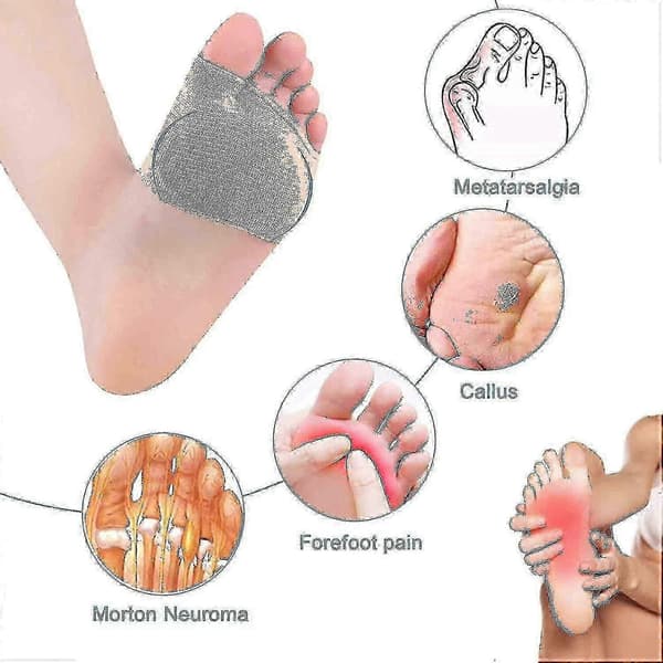 sesamoiditis smertelindring metatarsal puder mortons neurom [HK] S