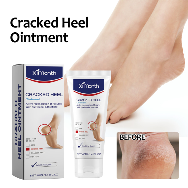 Dry Cracked Foot Cream Repair Häl Förhårdnader Fot Fuktgivande Anti-Dry Cracking Peeling Care 40ml